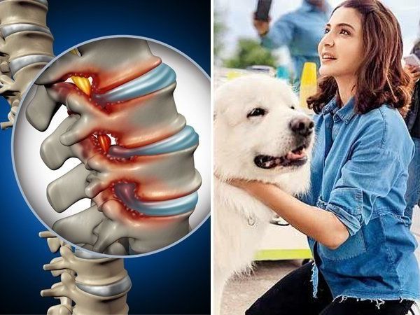 Anushka Sharma Suffering From Bulging Disc 